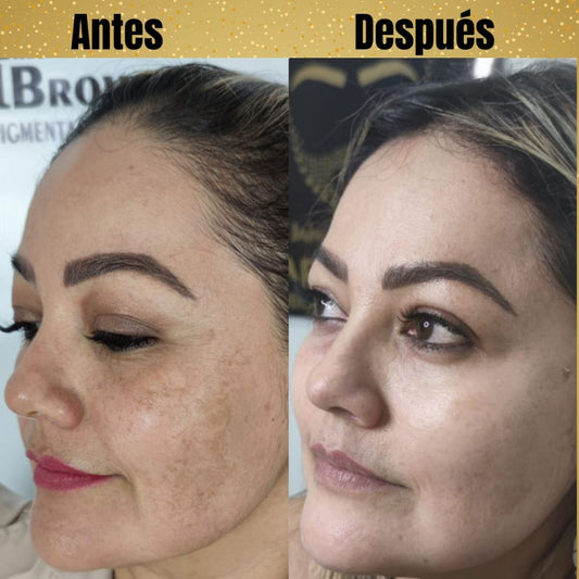 Tónico Despigmentante BB Glow Fusión "Piel de Porcelana"