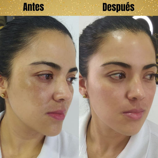 💧 Sérum Ácido Hialurónico "Firmeza en Cada Gota"